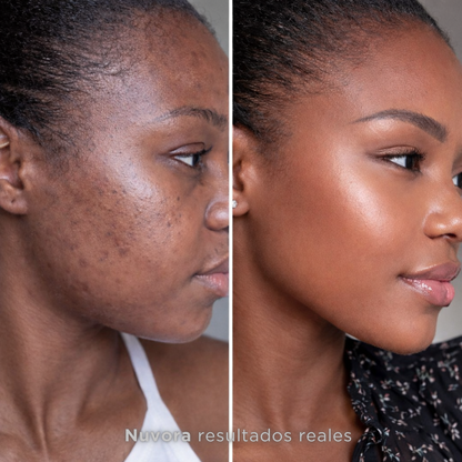 GlowLift LED – Piel más firme sin Botox